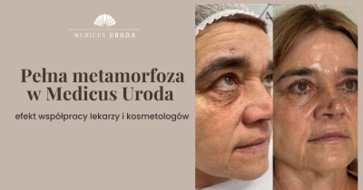 Pełna metamorfoza w Medicus Uroda – efekt współpracy lekarzy i kosmetologów